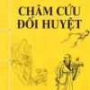 Châm Cứu Đối Huyệt