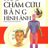 Học Châm Cứu Bằng Hình Ảnh